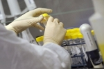 Санитарные врачи предупреждают о риске заражения холерой на Азовском море