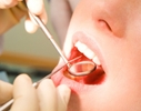 В России могут ввести стоматологическую страховку