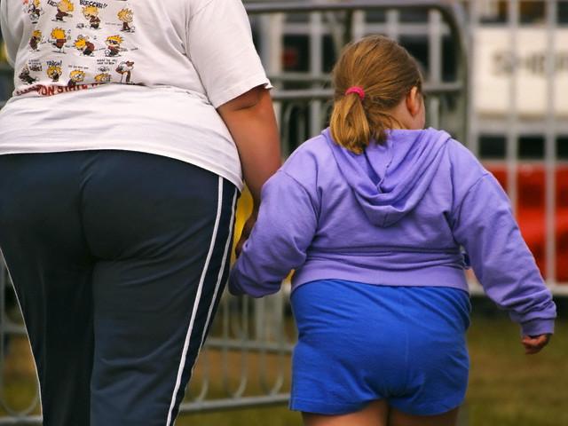 Самые толстые в России: на Урале 35% населения страдает ожирением